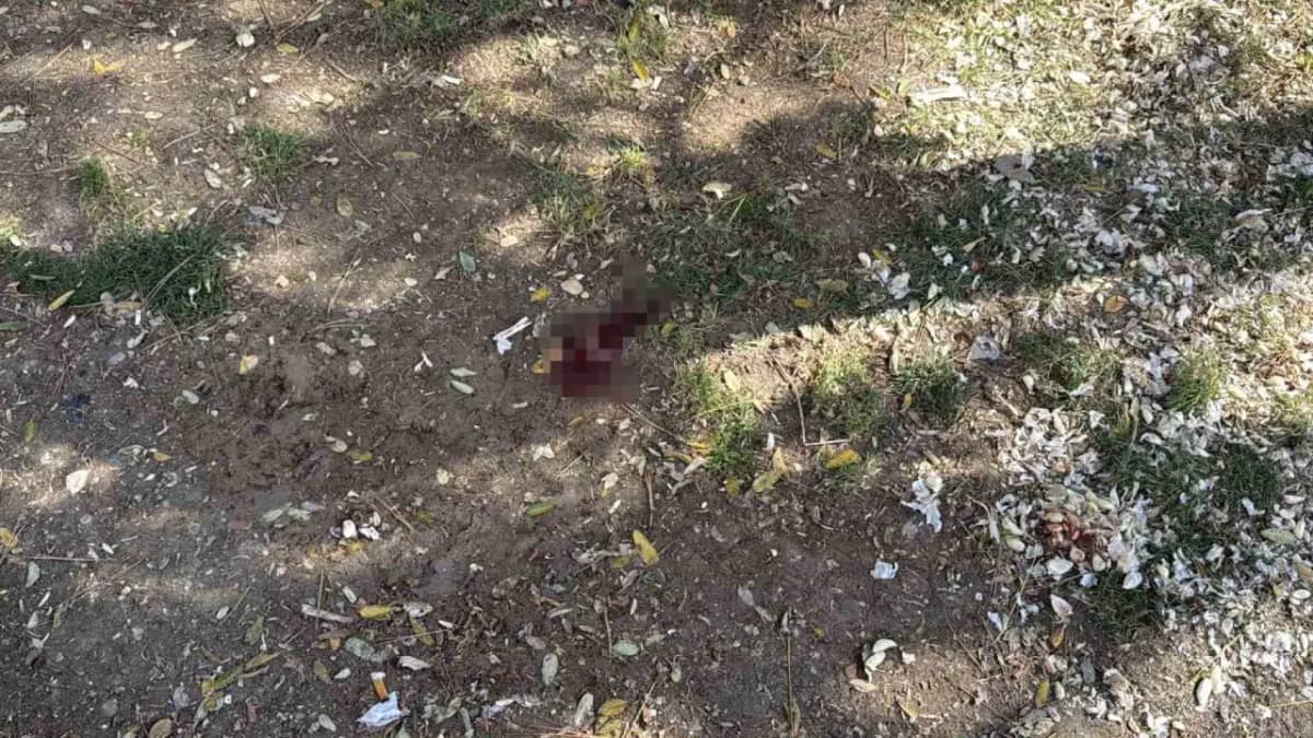 Parkta döner bıçaklı saldırı: Bir kişi yaralandı