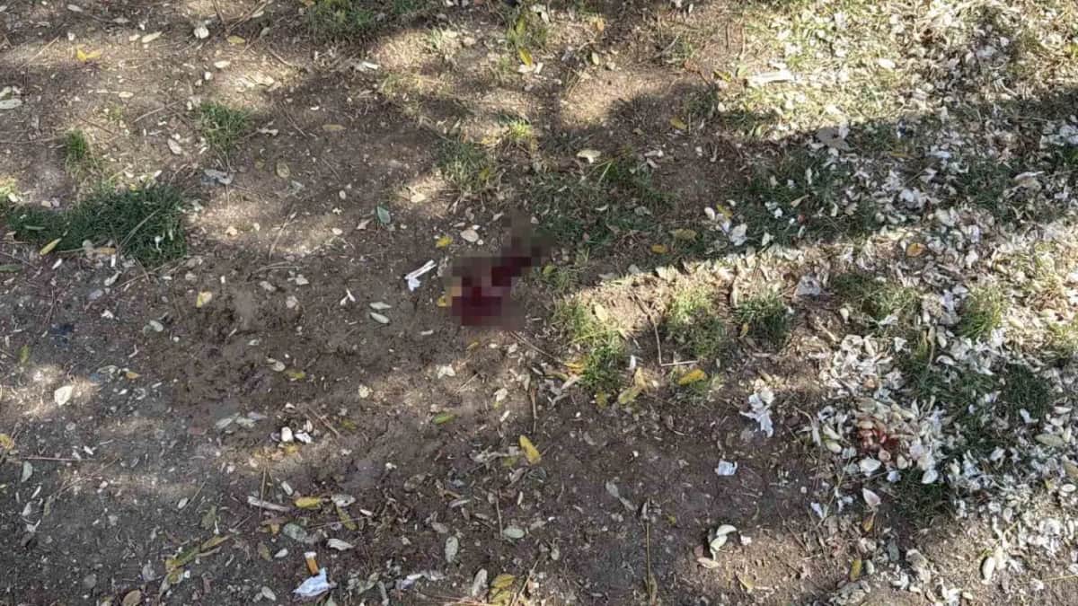 Parkta döner bıçaklı saldırı: Bir kişi yaralandı Parkta döner bıçaklı saldırı: Bir kişi yaralandı