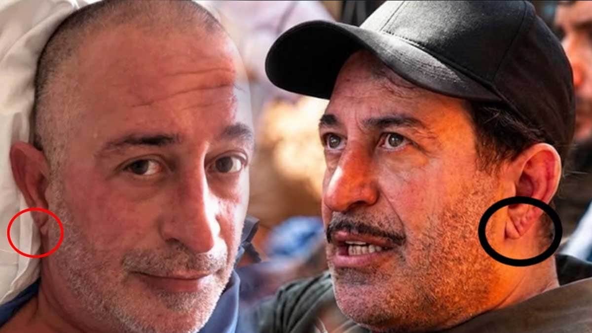 Kulak memesindeki çizgi (frank çizgisi) ne anlama geliyor, gerçekten kalp krizi belirtisi mi? Kulak memesindeki çizgi (frank çizgisi) ne anlama geliyor, gerçekten kalp krizi belirtisi mi?